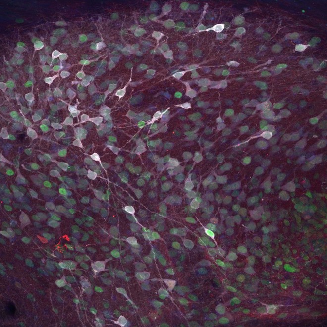 Una nuova frontiera per curare il Parkinson e le malattie neurodegenerative