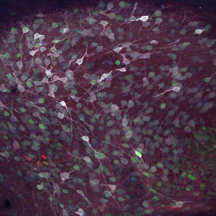 Una nuova frontiera per curare il Parkinson e le malattie neurodegenerative