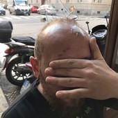 il barista aggredito dagli anarchici