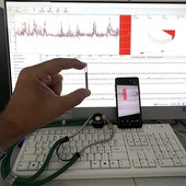 Strumentazione medica davanti a un monitor